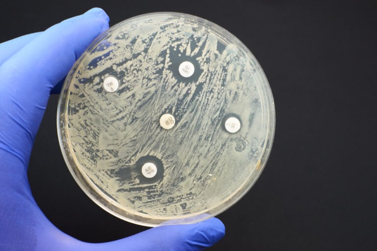 Petri dish with bacteria growing.