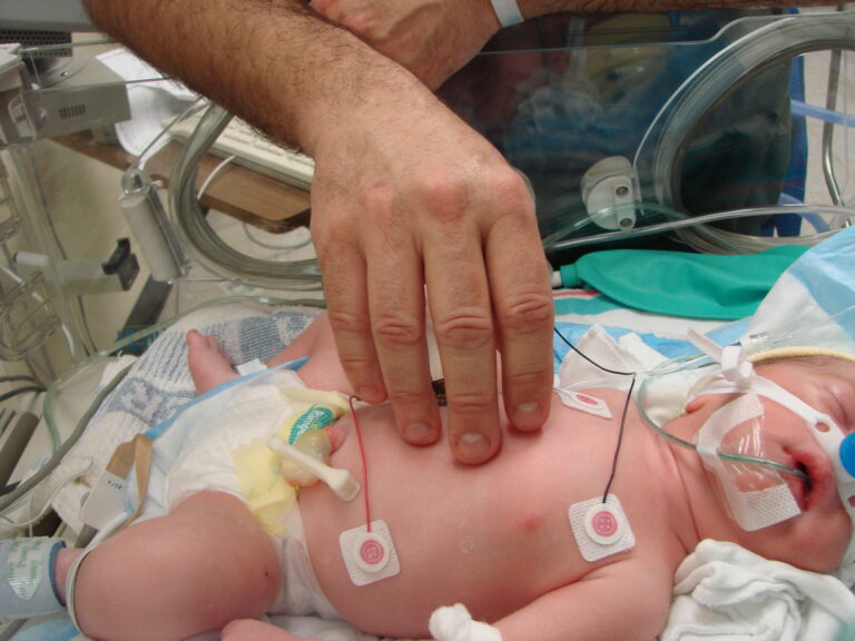 A hand touching an infant in intensive care.