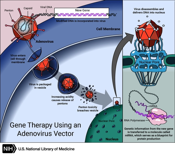 Illustration showing gene therapy using an adenovirus vector.